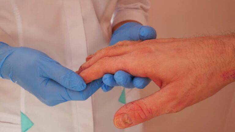 Dermatitis Demystified: Understanding Causes, Symptoms, and Treatments"