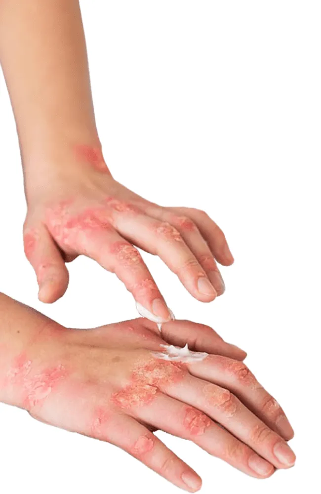 Hafoguard cream offers scientifically backed powerful key ingredients